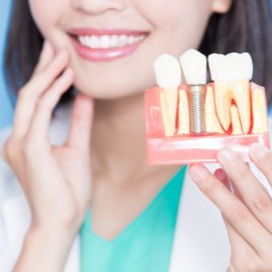 Cedarvale Dental Implants